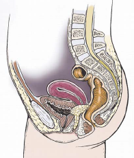 Cáncer de cérvix o cuello uterino